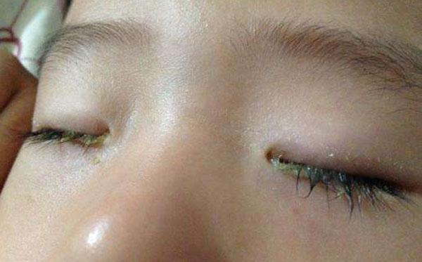 ������ʺ����ô���� ʲôԭ�����𱦱���ʺ��